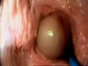 Internal view of a cumshot inside a pussy